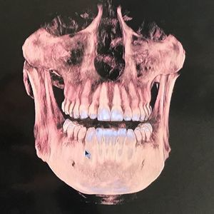 Meet your Posher, Solomon